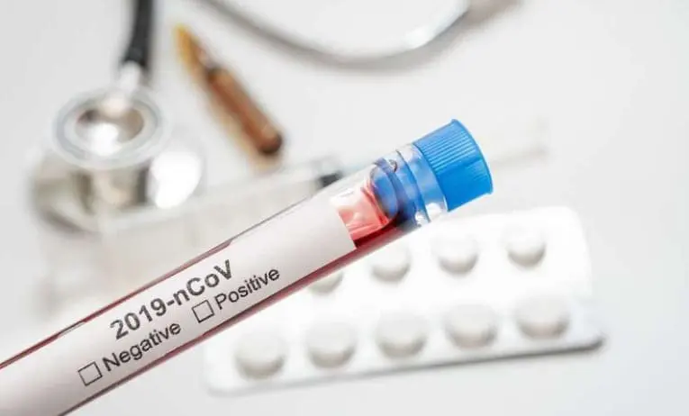 Diagnostico Covid
